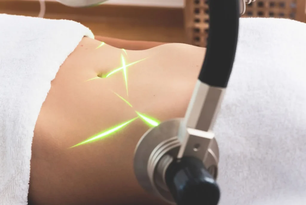 Combining Diet and Laser Treatments for Optimal Weight Loss