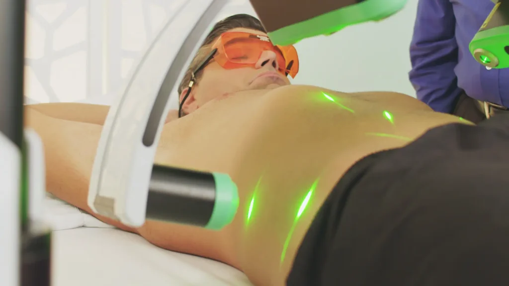 Is Cellulite Reduction Right for You?